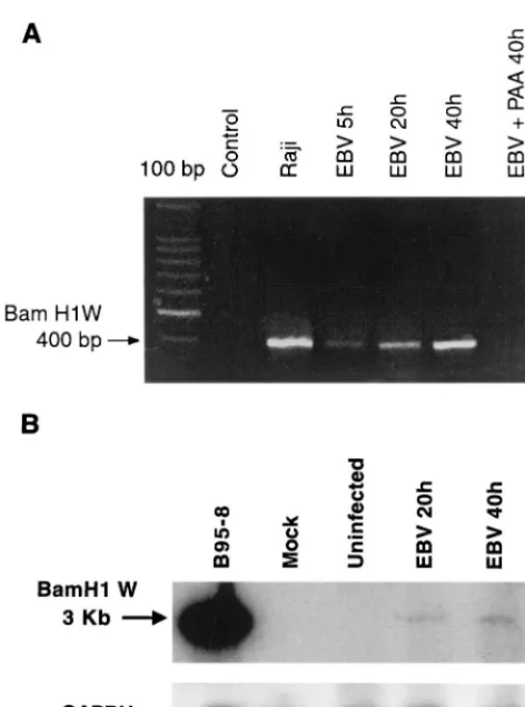 FIG. 2. Detection of EBV genome in infected monocytes. Monocytes (107cells) were treated with the phagocytosis inhibitor cytochalasin B (10M) for 10