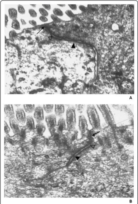 Figure 2 Electron microscopy of tight junctions of the smallintestine. Morphological analysis of tight junctions of the smallintestine of control animals A) and GvHD animals 2B) by electronmicroscopy