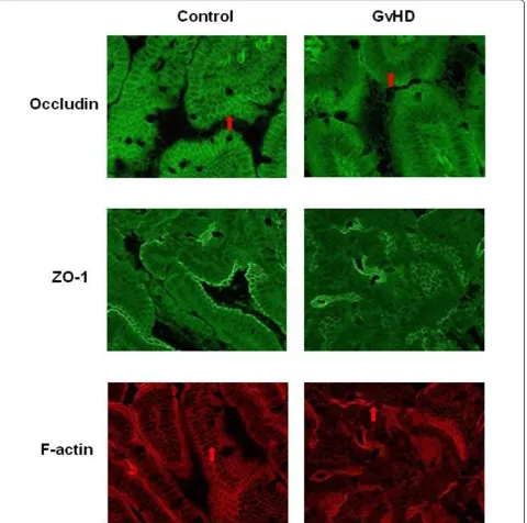 Figure 5 Intracellular localization of occludin, ZO-1 and F-actin in the jejunum. Localization of the tight junction proteins occludin (top),ZO-1 (middle) and the actin skeleton protein F-actin (bottom) in jejunum of GvHD-mice (n = 26) and control animals 