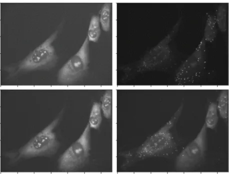 Figure 4.1: Example smFISH images. Columns are different color channels.