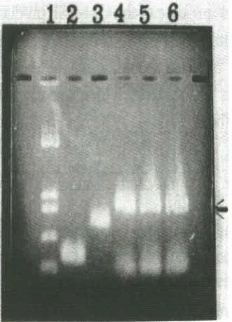Table 1. Oligonucleotide Primers used in splicing of the hGM-CSF gene. The ends of exons aremarked off with points