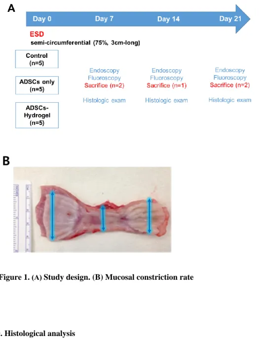 Figure 1.  (A)  Study design. (B) Mucosal constriction rate   