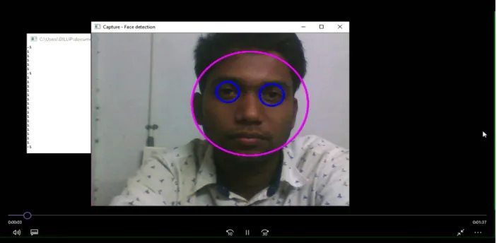 Figure 8: Eye in open state with head position= straight. Circle around the eye. 