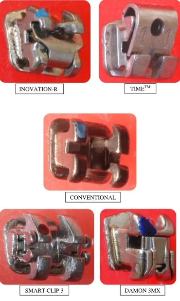 Figure 1: Brackets used in the study 