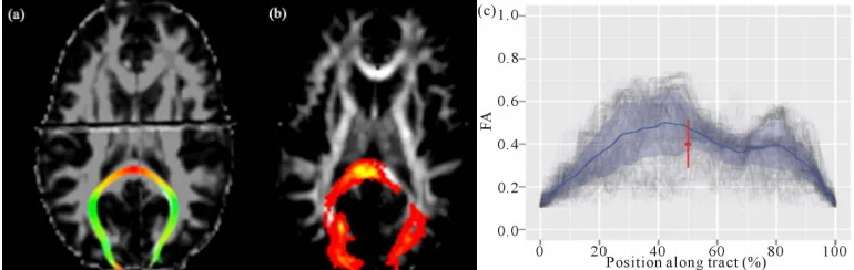 Figure 6. Reconstructed forceps major using streamline (a) and probabilistic (b) tractography, and the profile plots of FA values along the tract (gray lines) with the mean (blue line) and its standard deviation (read line) (c)