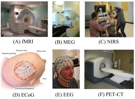 Figure 1.1: Neuroimaging techniques. (A) Siemens MAGNETOM Trio device for struc-tural and functional brain imaging