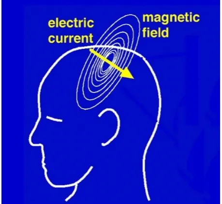Figure 2.3: The radial magnetic ﬁelds resulting from the tangential electrical currents canbe measured outside the scalp [205].