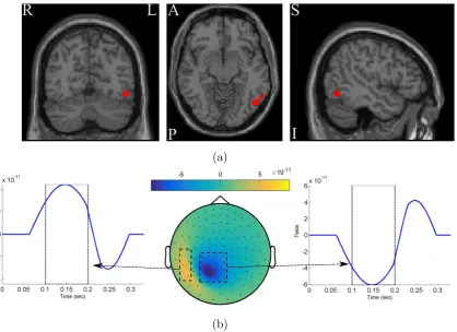Figure 3.6: (A)dipole direction. The red circles show the dipole position, and the red stick shows the (B) The spatio–temporal pattern of the discriminative ground–trutheﬀect.