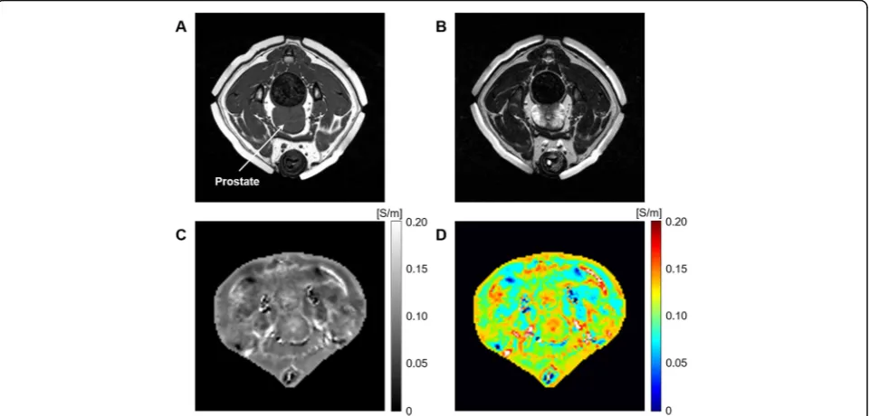 Figure 2 shows typical results of electrical conductivity-based MR imaging from an in vivo canine pelvis