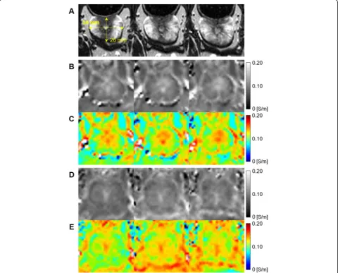 Figure 3three continuous slices from two canine prostates. The shows the electrical conductivity images withanatomical structure and size of the prostate can be