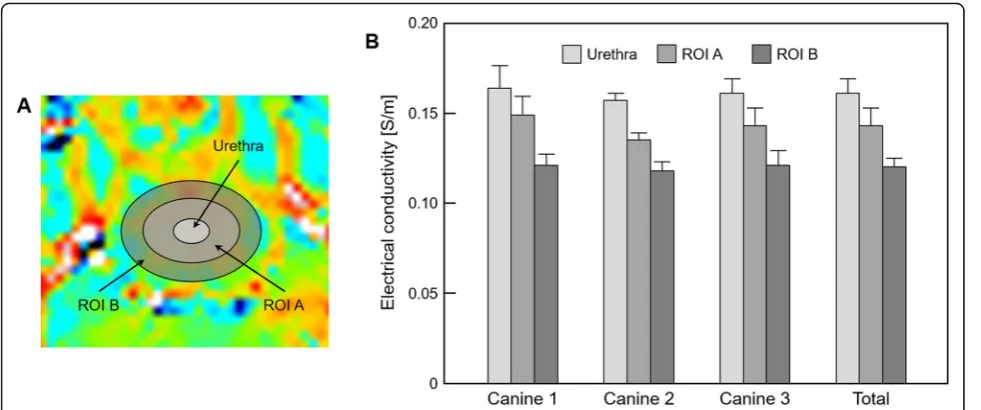 Fig. 4 Bar graph showing the comparison of prostatic tissues based on the contrast changes in electrical conductivity images.in three prostatic tissues, a ROIs are located b electrical conductivity is measured from the corresponding regions