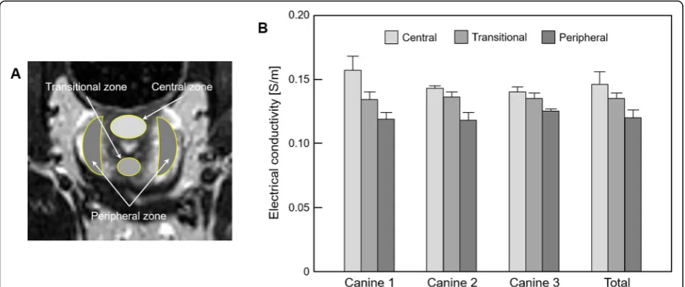 Table 2 Measurement of electrical conductivity of prostatic tissues based on the anatomical significance