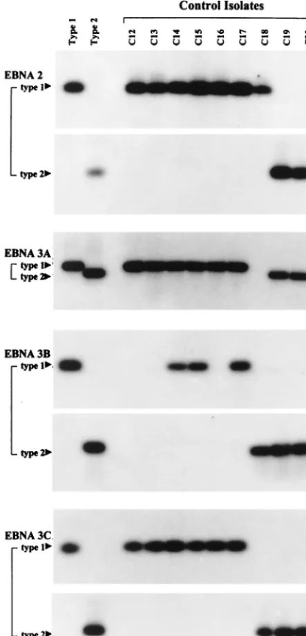 FIG. 1. Genomic typing of representative Chinese healthy control donorisolates C12 to C20 at the EBNA2, -3A, -3B, and -3C type-speciﬁc loci using