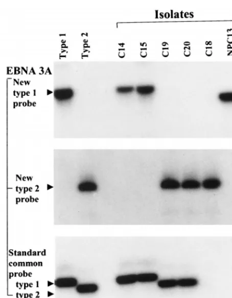 FIG. 3. Further analysis of EBNA3A gene type using new common 5�primers and probing with a new type 1-speciﬁc probe or with a new type 2-spe-ciﬁc probe compared to using the standard common primers and common probeat this locus