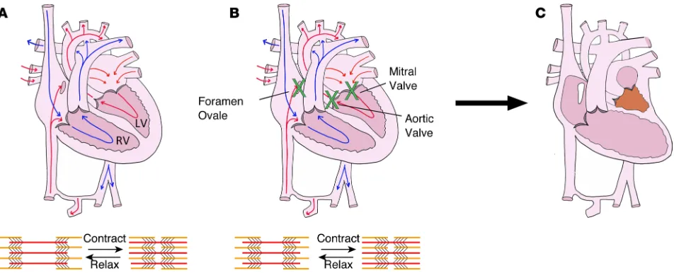 Figure 1. Perturbations in biomechanical stretch in utero can cause HLHS. (A) Drawing of a normal fetal heart