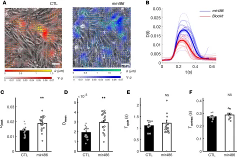 Figure 3. miR-486 increases the contractile function of cardiomyocytes in vitro. (value of the divergence of the displacement field, to contractility