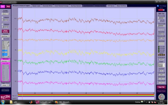 Figure 2.2: Real time raw EEG signals recorded by the ActiView software.