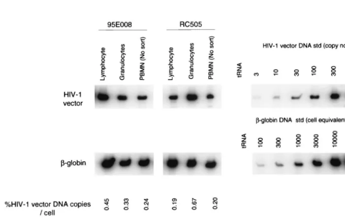 TABLE 1. Outcome of G-CSF- and SCF-mobilized peripheral blood transplantation using immunoselected CD34� cells