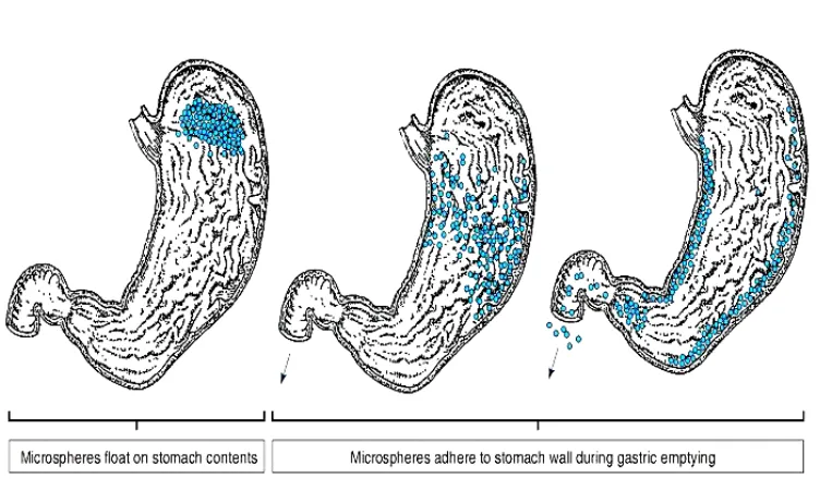 Fig – 4 Proposed mechanism for retention of microspheres in the human 