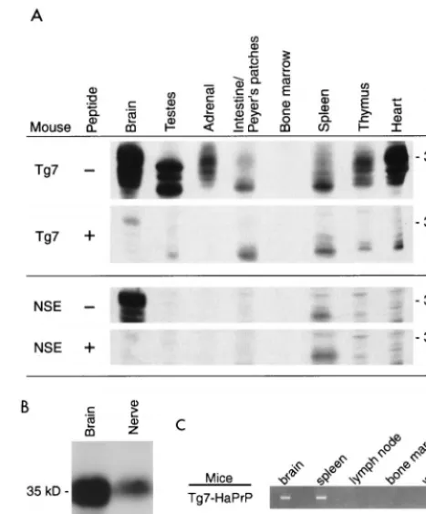 FIG. 1. HaPrP detection in various tissues of Tg7-HaPrP/MoPrP(�sciatic nerves (0.5 mg) were loaded per lane, and Western blots were developedas above