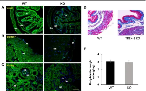 Fig. 2 Comparison of morphological phenotypes and spatial distribution of TREK-1 channel in visceral organs of WT and TREK-1 KO mice