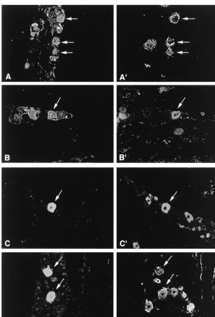 FIG. 1. Representative examples of KOS/62-infected TG tissue sections stained by dual immunoﬂuorescence to identify neuronal subpopulations expressing �100At 7 days p.i.,or HSV antigen
