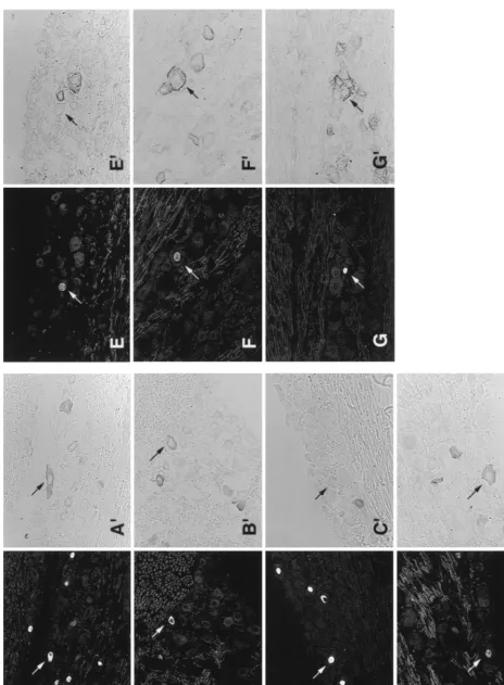 FIG. 2. Representative examples of KOS-infected TG tissue sections, 21 days p.i., assayed by FISH for LAT (A to G) and immunoperoxidase for speciﬁc neuronal subpopulations (Am., CGRP, b-NOS, SP, KH10, A5, and SSEA3 antisera, respectively