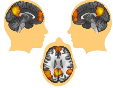 Figure 2.3. Main regions of the DMN. Current representation of the four main regions of the DMN located in the posterior cingulate, bilateral temporo-parietal cortex and medial prefrontal cortex/anterior cingulate (Photo/Courtesy of Sarah Gimbel/USC)