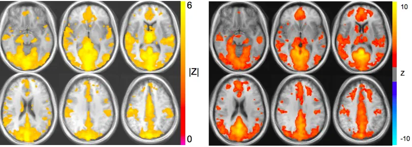 Figure 2.4. Spatial distribution of physiological noise compared with intrinsic DMN connectivity