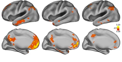 Figure 2.7. Surface maps revealing differences in head-motion in the main DMN 
