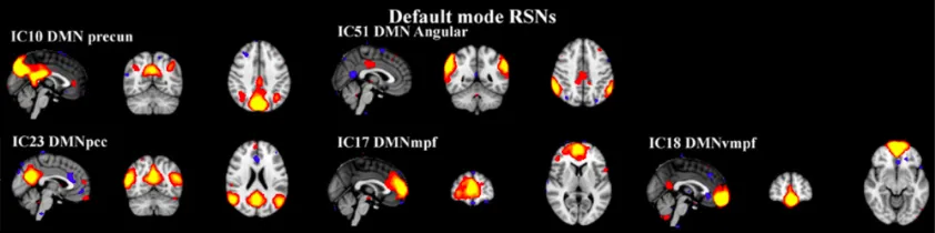 Figure 2.10. The DMN splitting phenomenon following ICA. The figure shows  an example of 