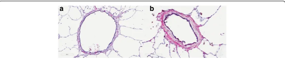 Fig. 2 Comparison of non-asthmatic airway (changes within the airways. Scale bar is 200a) and asthmatic airway (b)