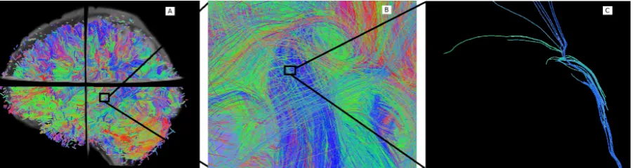 Figure 1.1: (A) Tractography overlaid with the structural image (only 10% of thestreamlines are shown)
