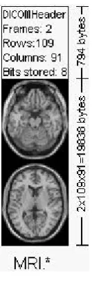 Figure 2.1: An example of the DICOM image ﬁle. The image is reproduced from http: