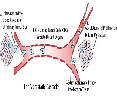 Fig 6 represents the Metastatic Cascade 