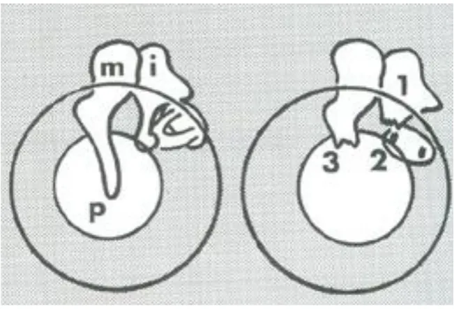 Figure.8:Resorptive osteitis 