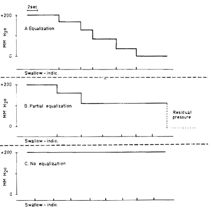 Figure.13: Inflation test of Eustachian tube function 