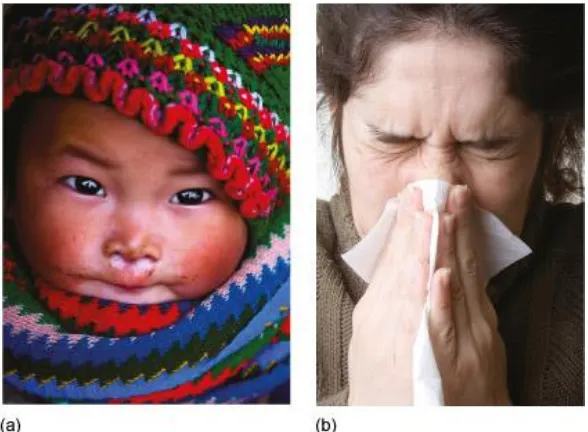 Figure 1. The common cold affects children and adults all over the world: (a) a child from Vietnam