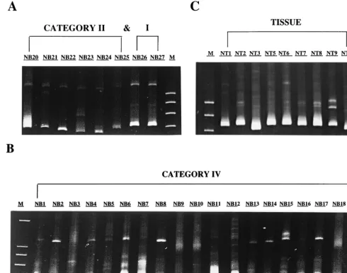 FIG. 4. Hetroduplex mobility analysis of proviral variants from PBMCs of 27 blood-derived isolates from categories I and II (A) and category IV (B) of HIVinfection and from tissue (C)