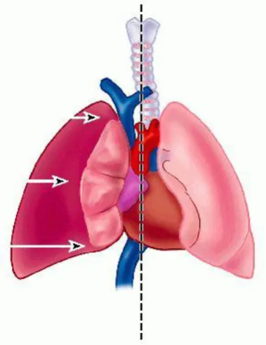 Figure 1 Relationship between pleura and pericardium14 