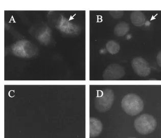 FIG. 5. ASFV dUTPase expression in infected cells analyzed by Westernblot. Mock-infected or ASFV-infected Vero cells were lysed at different times