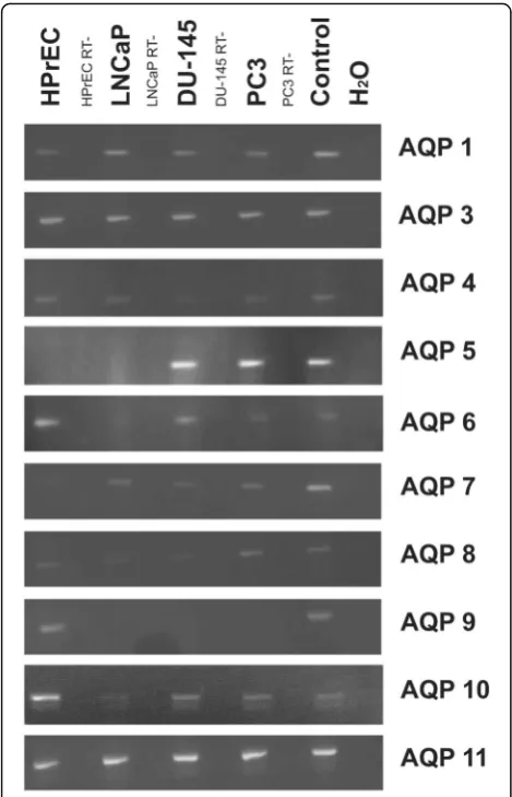 Fig. 1 AQP transcript expression: RT-PCR results of AQP 0–12 innormal prostate epithelial cells (HPrEC) and in established PC lines(LNCaP, DU-145 and PC3)