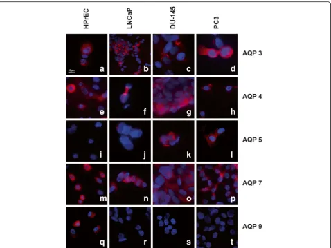 Fig. 2 Immunofluorescence labelling of HPrEC, LNCaP, DU-145 and PC3 cell lines. Intense expression of AQP 3 (a-d) AQP 4 (e-h) and AQP 7 (m-p)in all cell lines