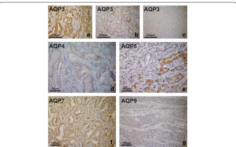 Fig. 5 Spearman correlation of mRNA expression of AQP 3, AQP 4, AQP 7 and AQP 9 with clinicopathological parameters