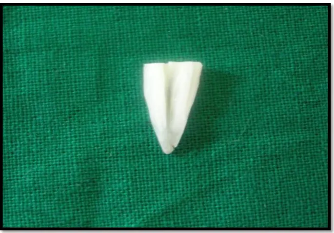 Fig.4: Cleaning and shaping 