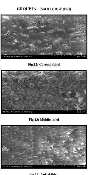 Fig.13: Middle third 