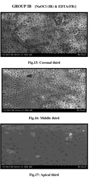 Fig.15: Coronal third 