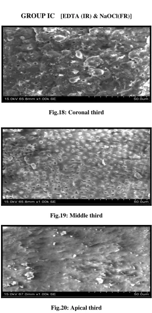 Fig.20: Apical third 