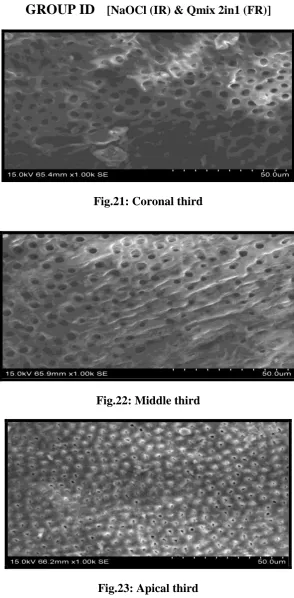 Fig.23: Apical third 