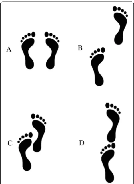 Figure 5 Base of support during static balance sensor-basedassessments. (A) bipedal stance, (B) near-tandem stance,(C) semi-tandem stance, (D) tandem stance
